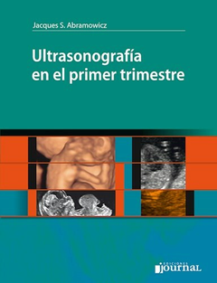 Ultrasonografia en el primer trimestre - Abramowicz - Ediciones Journal