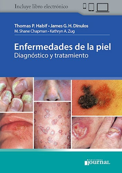 Enfermedades de la piel ( Diagnóstico y tratamiento ) - Thomas P. Habif - Ediciones Journal