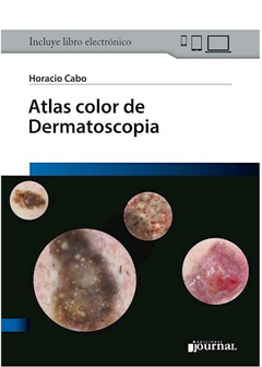 Atlas color de Dermatoscopia - Horacio Cabo - Ediciones Journal