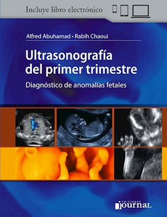 Ultrasonografia del primer trimestre - Abuhamad/Chaoui - Ediciones Journal