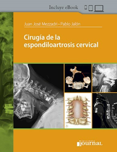 Cirugia de la espondiloartrosis cervical - Mezzardi/Jalon - Ediciones Journal