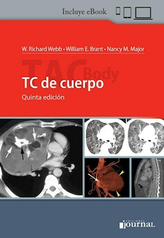 TC de cuerpo - Webb/Brant/Major - Ediciones journal