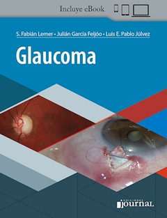 Glaucoma - Fabian Lerner - Ediciones Journal