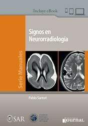 Signos en Neurorradiologia - Pablo Sartori - Ediciones Journal