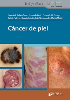 CANCER DE PIEL - CABO/GATTI/STENGEL/SALERNI/ETC - EDITORIAL JOURNAL