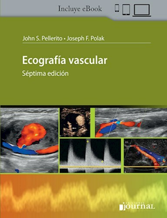 Ecografia vascular - Pellerito/Polak - Ediciones Journal