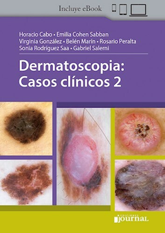 Dermatoscopia: Casos clinicos 2 - Horacio Cabo - Ediciones Journal
