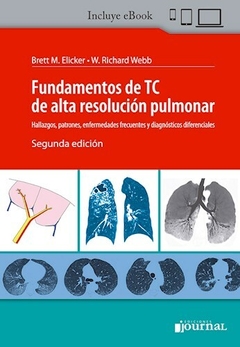 Fundamentos de TC de alta resolución pulmonar - Richard Webb Brett M. Elicker - Editorial Journal