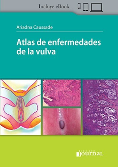 Atlas de enfermedades de la vulva - Caussade - Ediciones Journal