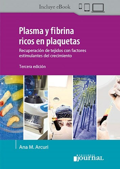 PLASMA Y FIBRINA RICOS EN PLAQUETAS - ANA M.ARCURI