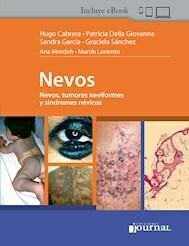 Nevos - Hugo Cabrera - Ediciones Journal
