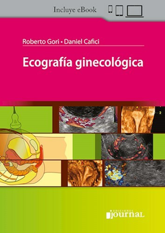 Ecografía ginecológica - Daniel Cafici Roberto Gori -Editorial Journal