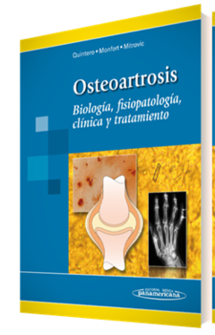 Osteoartrosis - Quintero/Monfort/Mitrovic - Editorial Medica Panamericana