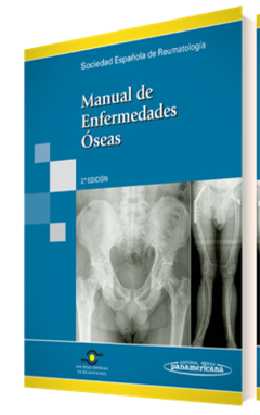 Manual de Enfermedades Oseas - S.E.R - Editorial Medica Panamericana