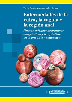 Enfermedades de la vulva, la vagina y la region anal - Tatti - Editorial Medica Panamericana